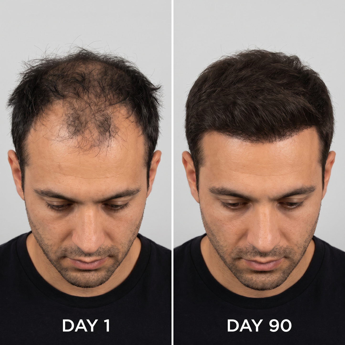 RegrowLab™ Red Light Hat