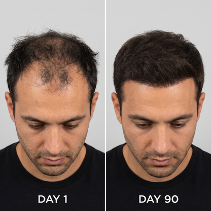 RegrowLab™ Red Light Hat